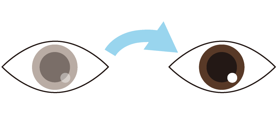 かくまくの交換